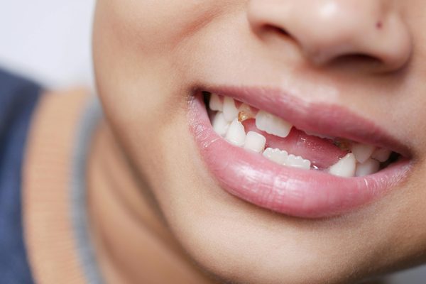 Le site de la petite souris des dents de lait : magie et conseils pour enfants